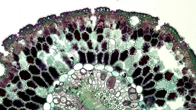Liver Disease Is Often Silent — Here's How to Find It Early