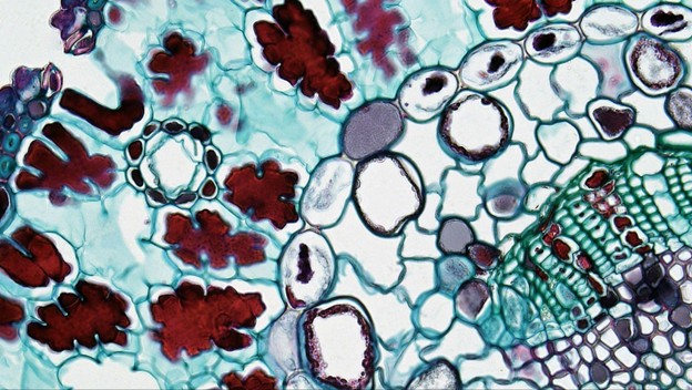 The Real Reason Antibiotics Don’t Always Finish the Job