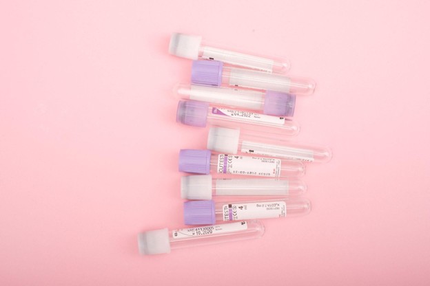 How Hashimoto's Is Diagnosed, and Why Catching It Early Protects Your Thyroid